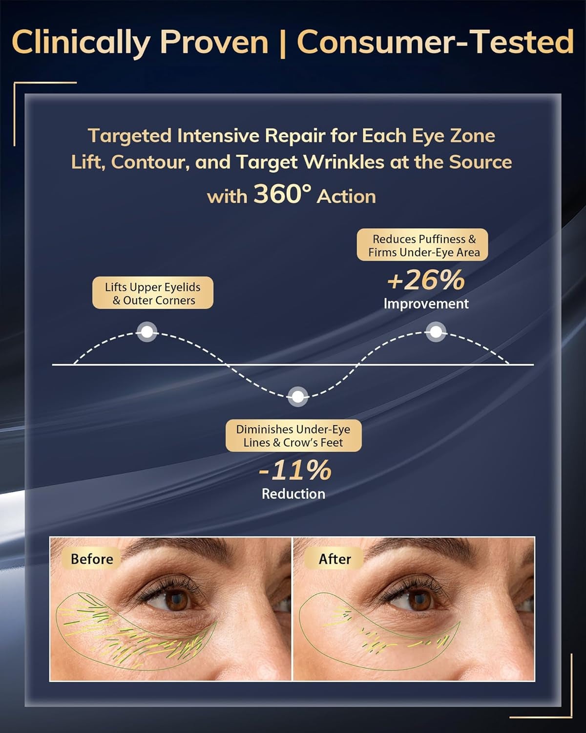 Under Eye Red Light Therapy Device, Red Light Therapy Glasses for Eyes 630±10Nm,Red Light Eye Mask for the Treatment of Eye Bags,Dark Circles,Puffiness Periorbital for Treating