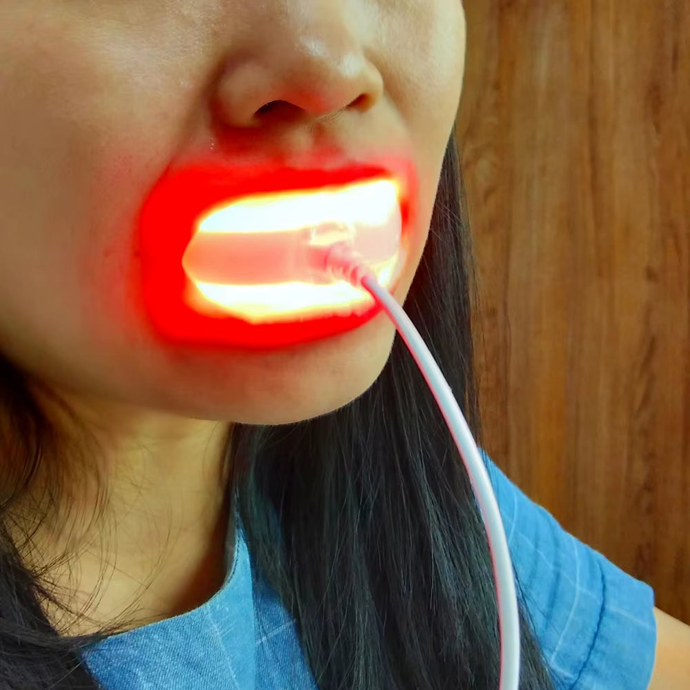Starlite Smile Gum Disease Treatment, Periodontal Treatment Oral Care Red Light Therapy Promotes Healing and Pain Relief